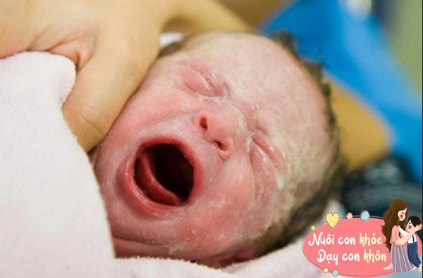 Bật mí những bộ phận trẻ sơ sinh phải xấu chứng tỏ con khỏe mạnh mẹ chớ vội buồn - 8