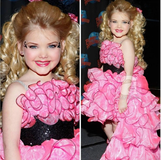 Bé gái 6 tuổi được mẹ cho tiêm botox 3 thánglần thi hoa hậu 10 năm sau nhận không ra - 2