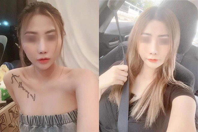 Cô gái kể chuyện sửa mũi hỏng tại bác sĩ hồ phi nhạn - 3