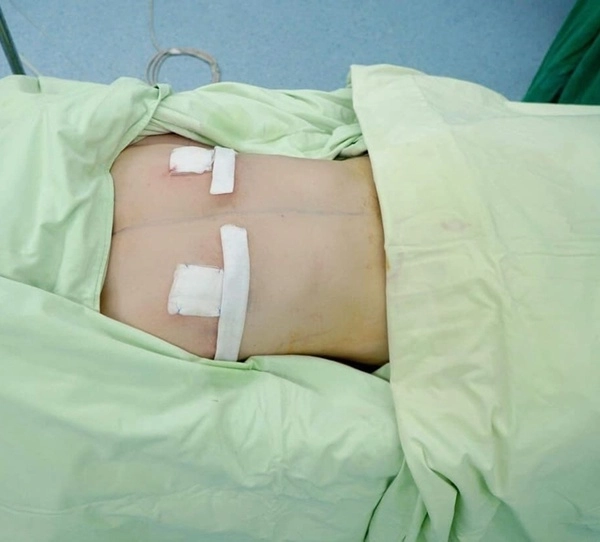 Hậu cắt ngực bạn trai chuyển giới của miko lan trinh đẹp như nam thần - 6