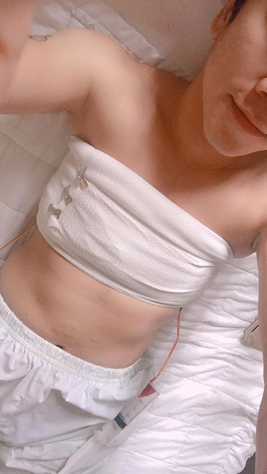 Hậu cắt ngực bạn trai chuyển giới của miko lan trinh đẹp như nam thần - 8