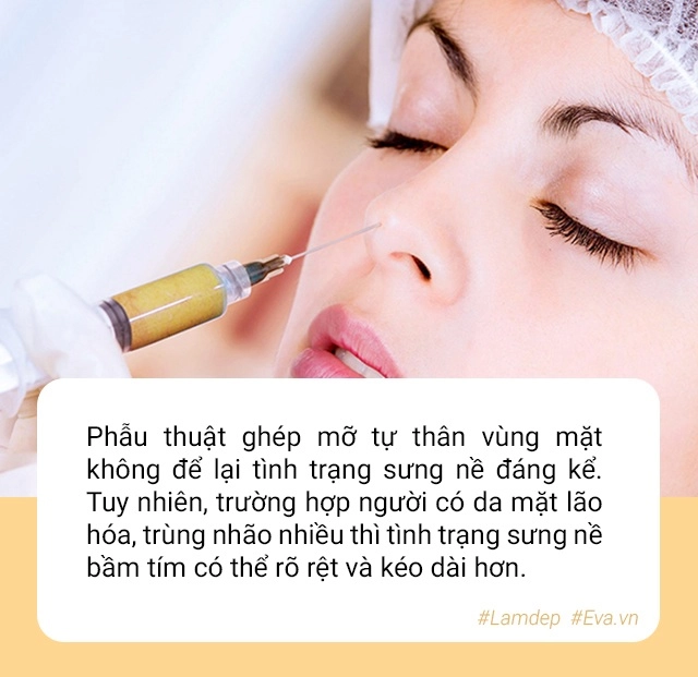 Hoa hậu indonesia hỏng mặt vì phẫu thuật thẩm mỹ chuyên gia nói gì về trường hợp này - 8