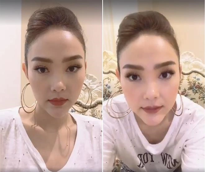 Hội bạn thân đông nhi liên tục vướng nghi vấn dao kéo người cằm nhọn hoắt người vẹo cả mũi - 8
