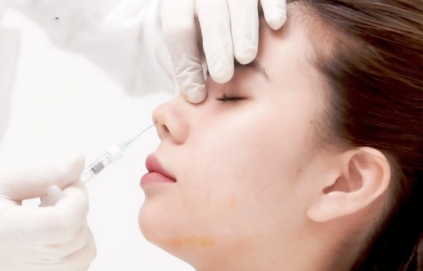 Mê tiêm filler giá rẻ nhiều chị em đối mặt hậu quả rùng mình mặt sưng mũi mưng mủ - 6