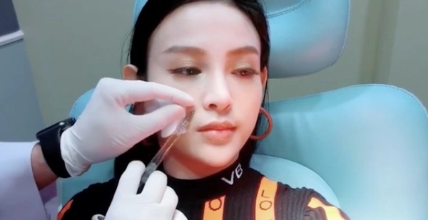 Mê tiêm filler giá rẻ nhiều chị em đối mặt hậu quả rùng mình mặt sưng mũi mưng mủ - 10