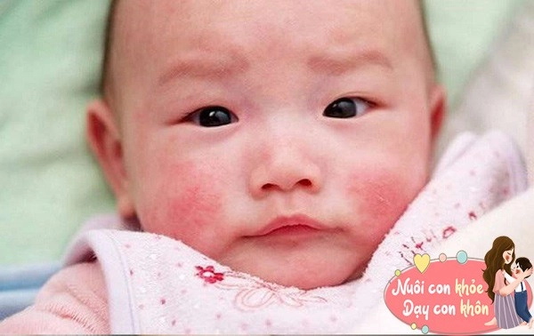 Mẹo chăm sóc trẻ sơ sinh mùa thu khỏe mạnh không sợ ốm vặt đến lúc mẹ phải học - 12