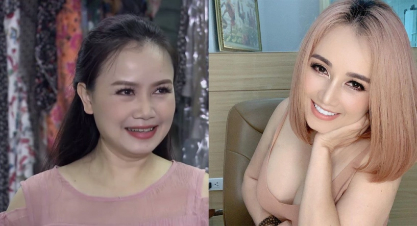 Nâng mũi chưa lâu đã gặp tai nạn chị em gặp tình cảnh như cô xuyến cần làm gì - 4
