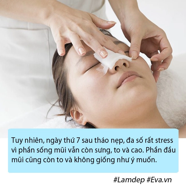 Nâng mũi chưa lâu đã gặp tai nạn chị em gặp tình cảnh như cô xuyến cần làm gì - 6