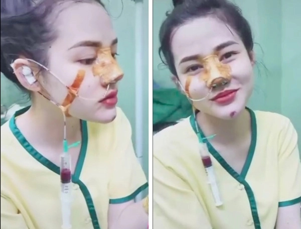 Nữ hoàng livestream việt nổi giận khi bị chê sửa mũi quá xấu - 3