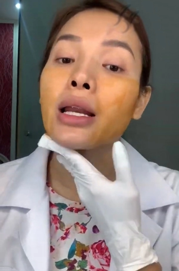 Phương trinh jolie tự tay tiêm thon mặt mà dân mạng phải choáng theo - 9