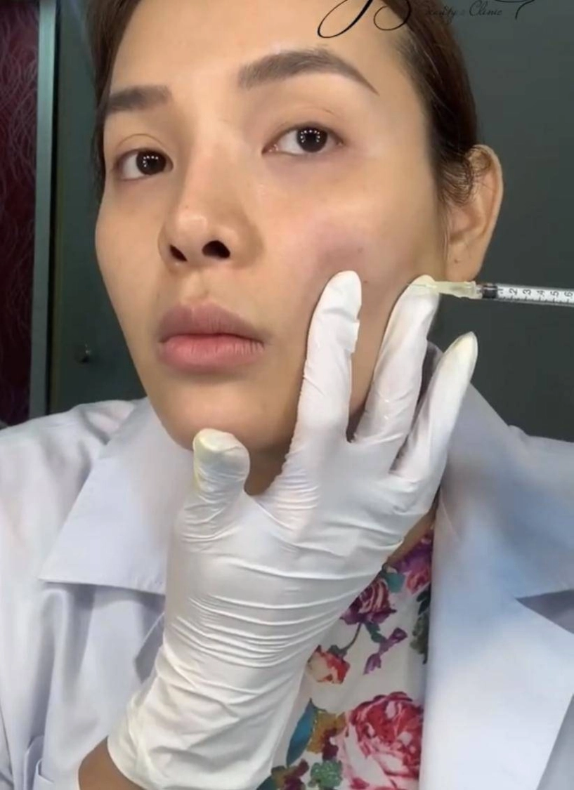 Phương trinh jolie tự tay tiêm thon mặt mà dân mạng phải choáng theo - 10