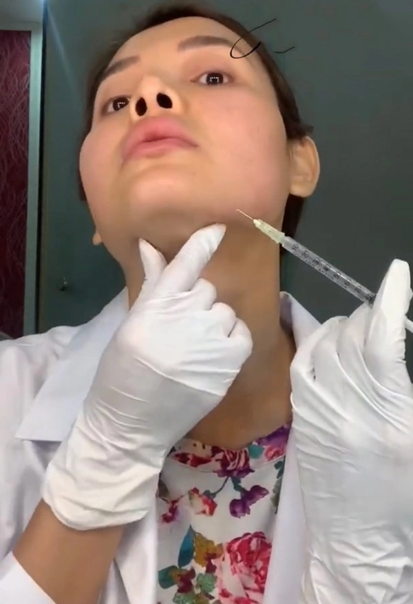 Phương trinh jolie tự tay tiêm thon mặt mà dân mạng phải choáng theo - 11