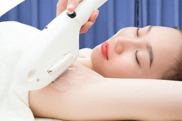 Triệt lông nách biện pháp thẩm mỹ cứu cánh của phái đẹp ngày hè oi bức - 4