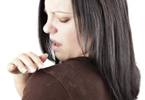 7 điều tồi tệ xảy ra khi bạn để đầu bẩn - 1