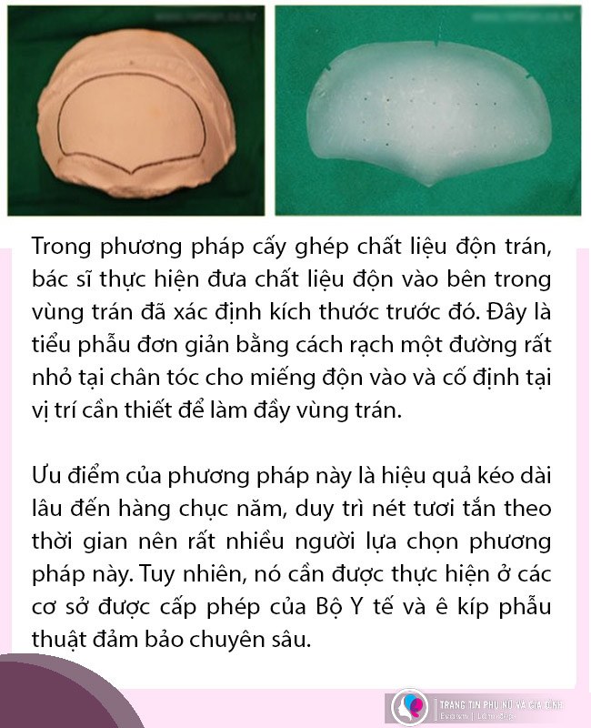 Đi độn trán chưa thấy vầng trán thanh lịch đâu cô nàng nhận về cái kết sưng như ong chích - 7