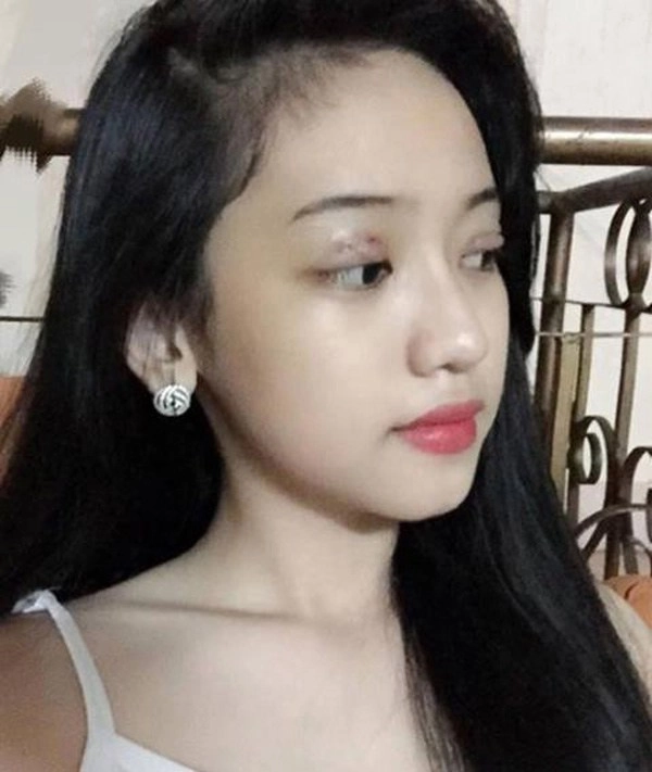 Khổ sở như thuý vi tốn tiền tỷ thẩm mỹ mà lâu lâu lại bị chê xấu - 3