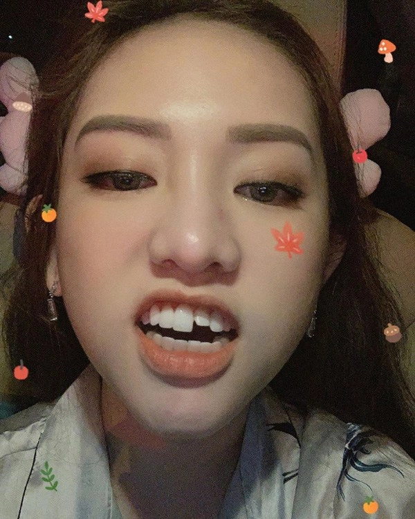 Khổ sở như thuý vi tốn tiền tỷ thẩm mỹ mà lâu lâu lại bị chê xấu - 5