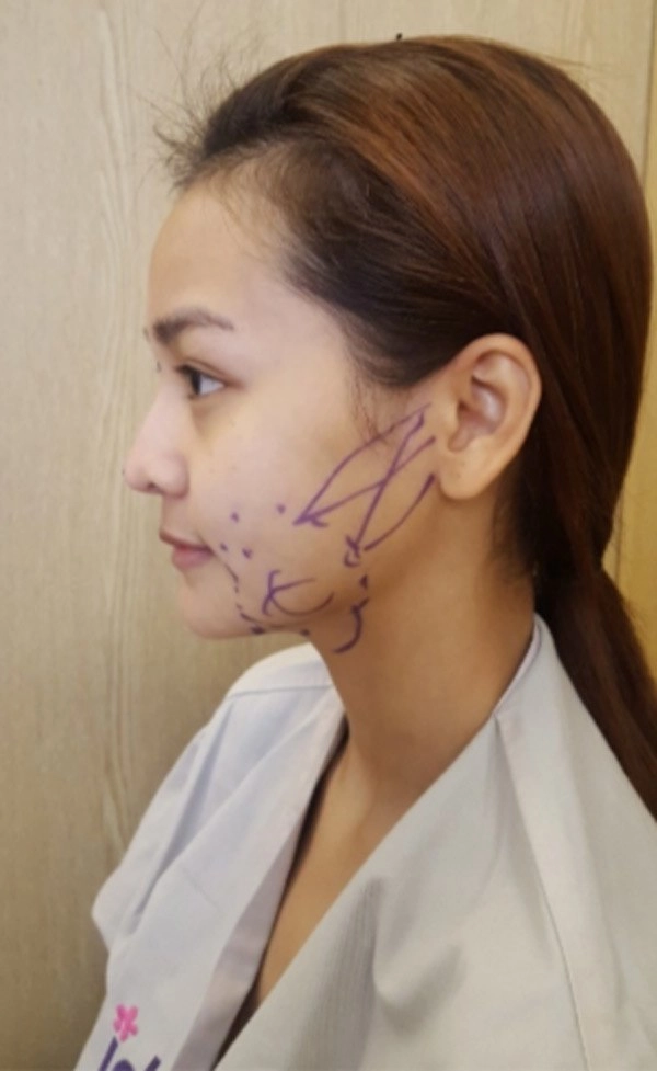 Nàng hậu mới đăng quang lịch sử dao kéo bị lật lại đầy trên mạng xã hội - 6