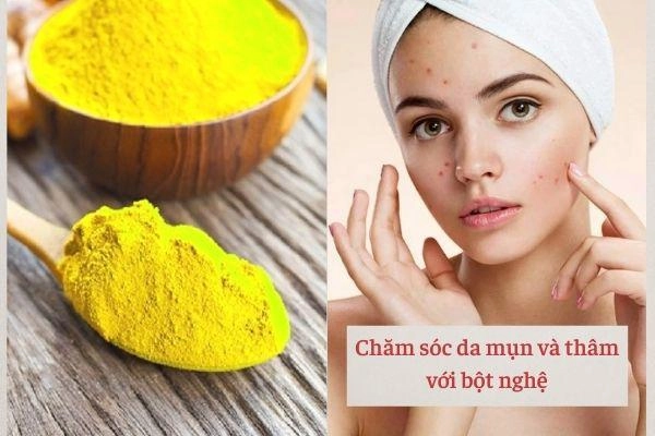 Những bí quyết phải nằm lòng khi chăm sóc da mụn nàng làm theo tết này da căng bóng - 1