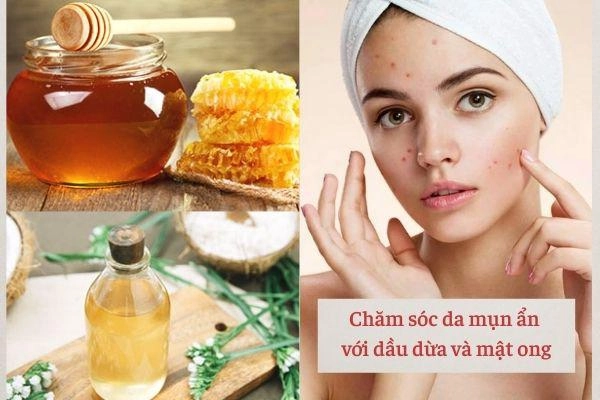 Những bí quyết phải nằm lòng khi chăm sóc da mụn nàng làm theo tết này da căng bóng - 2