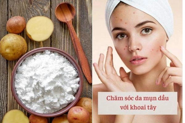 Những bí quyết phải nằm lòng khi chăm sóc da mụn nàng làm theo tết này da căng bóng - 3