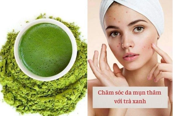 Những bí quyết phải nằm lòng khi chăm sóc da mụn nàng làm theo tết này da căng bóng - 4