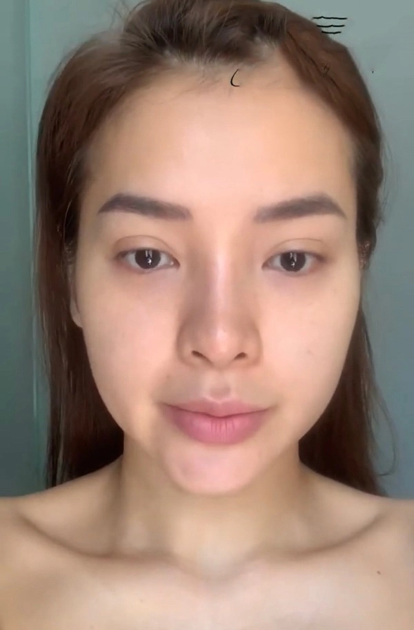 Phương trinh jolie tự tay tiêm thon mặt mà dân mạng phải choáng theo - 14