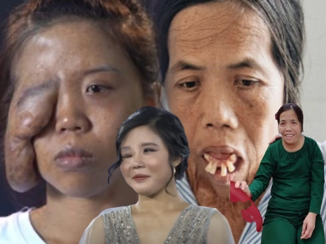 Phương trinh jolie tự tay tiêm thon mặt mà dân mạng phải choáng theo - 19
