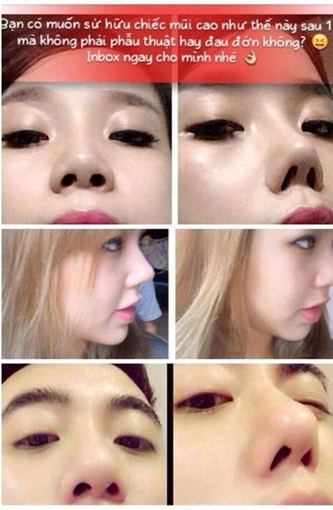 Từng bị bóc photoshop bóp mặt ảo bồ trẻ chồng cũ lệ quyên vẫn tự tin khoe mũi hàng real - 15