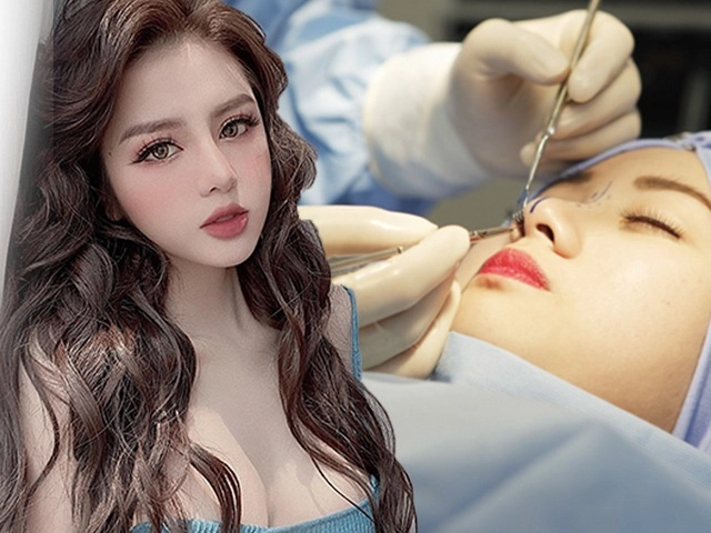 Nâng mũi xong về mụn nổi ầm ầm chị em bình tĩnh đọc kĩ bài viết này - 14