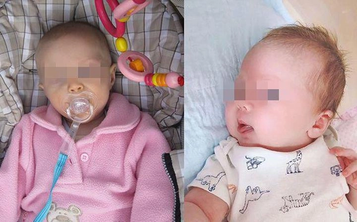 Con chào đời da trắng bóc tóc vàng bố công khai làm adn chẩn đoán khiến tất cả suy nghĩ - 1