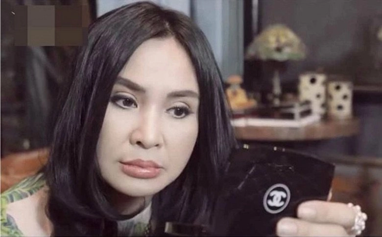 Diva thanh lam bị hoài nghi nhan sắc vì môi căng phồng mắt như nhấn mí - 1