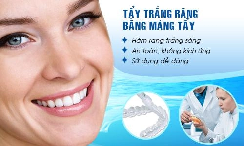 Tẩy trắng răng có hại gì với sức khỏe và những đối tượng không nên tẩy - 3