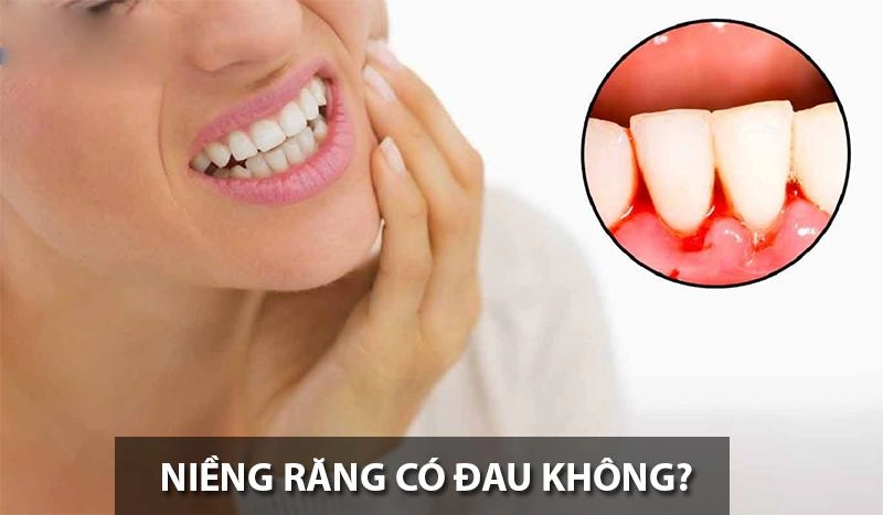Tẩy trắng răng có hại gì với sức khỏe và những đối tượng không nên tẩy - 6