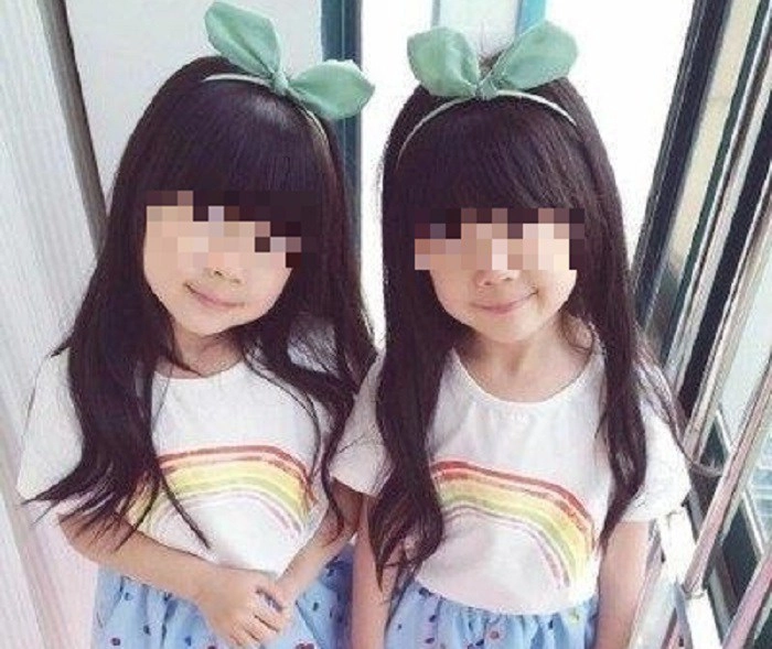 Hai con gái song sinh quá khác nhau chồng bí mật xét nghiệm adn vạch trần bí mật của vợ - 1