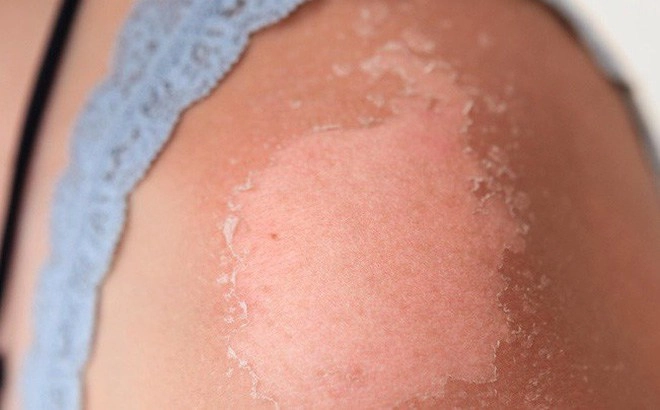 Hotgirl có tài sản 50 tỷ kêu cứu vì bị lột da chị em đi biển nên cẩn thận - 5