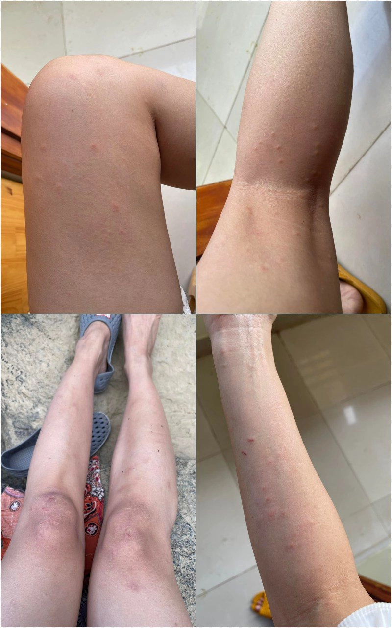 Hotgirl có tài sản 50 tỷ kêu cứu vì bị lột da chị em đi biển nên cẩn thận - 7