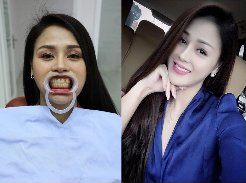 Hướng dương ngược nắng lương thu trang đăng ảnh ăn mày quá khứ nhan sắc lạ lẫm khó nhận ra - 7