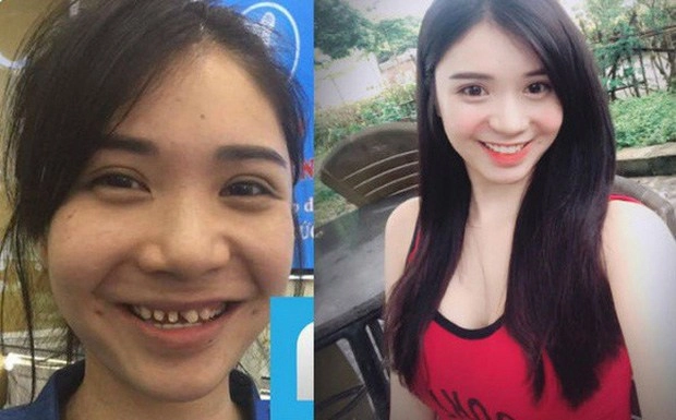 Làng nhan sắc xém nữa đã có 1 vụ kiện giữa hai mỹ nhân chỉ vì chuyện làm răng sứ - 20