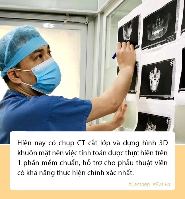 Nam thanh niên lột xác sau 2 năm gọt hàm hết hồn với chiến tích cầm về năm nào - 9