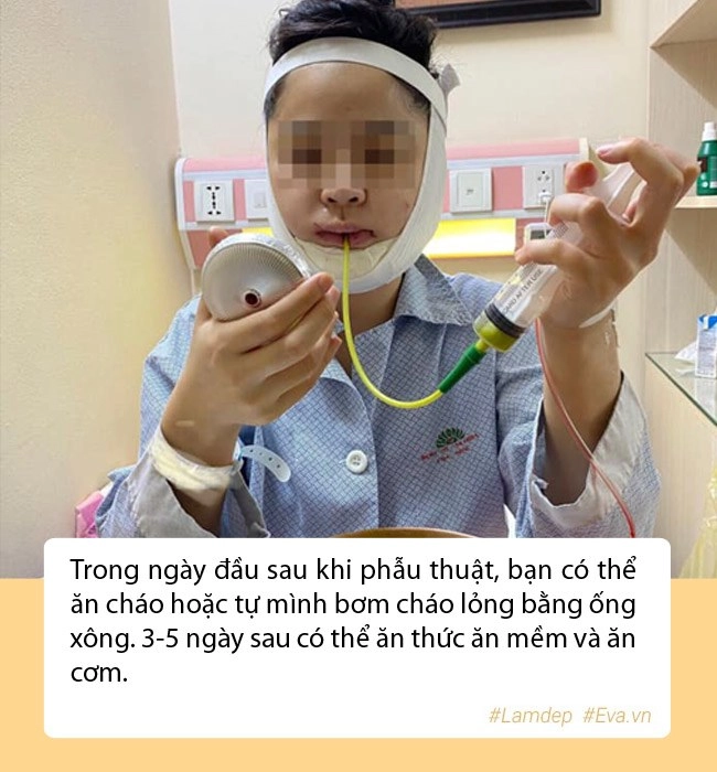Nam thanh niên lột xác sau 2 năm gọt hàm hết hồn với chiến tích cầm về năm nào - 11