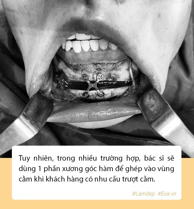 Nam thanh niên lột xác sau 2 năm gọt hàm hết hồn với chiến tích cầm về năm nào - 12