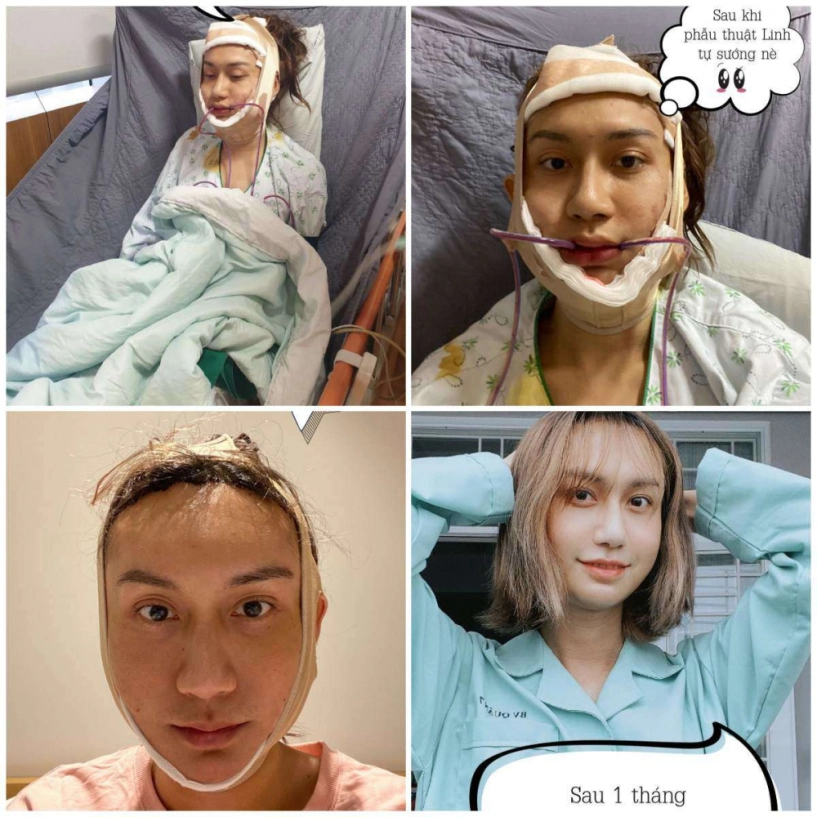 Oái ăm câu chuyện dao kéo vòng 1 đình đám nhất năm 2020 người độn to người cắt bỏ - 2