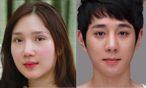 Sao nam châu á công khai thẩm mỹ tiến hành từ 4 năm trước giờ vẫn còn đẹp - 11
