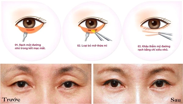 Sao nam châu á công khai thẩm mỹ tiến hành từ 4 năm trước giờ vẫn còn đẹp - 12