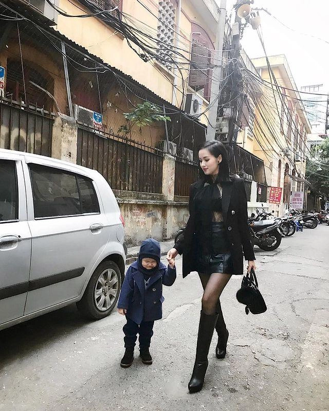 Tâm tít chi bộn tiền cho một món thời trang nhằm phẫu thuật thẩm mỹ chân vòng kiềng - 9