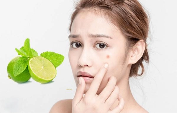 15 cách trị thâm mụn tại nhà cấp tốc hiệu quả nhanh nhất - 1