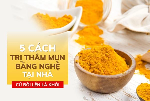 15 cách trị thâm mụn tại nhà cấp tốc hiệu quả nhanh nhất - 2