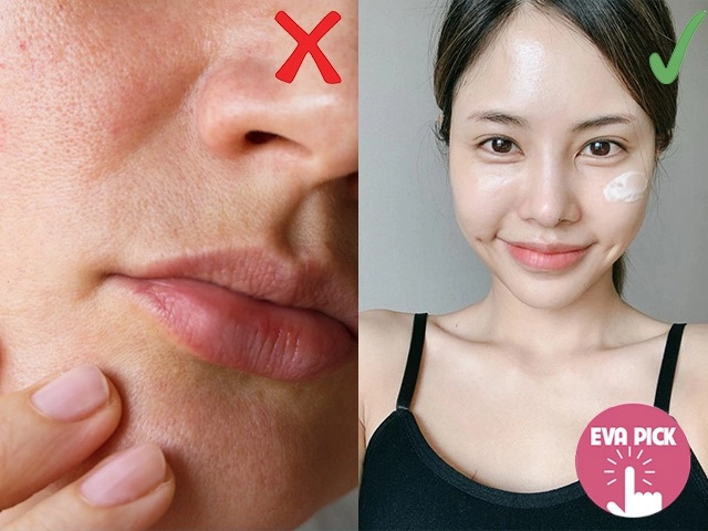 Cách chăm sóc da mụn và thâm đúng cách tại nhà hiệu quả nhanh nhất - 10