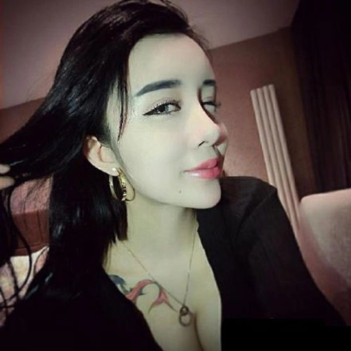 Cô gái 15 tuổi mặt cứng đờ vì thẩm mỹ quá đà - 2